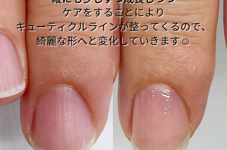 爪写真