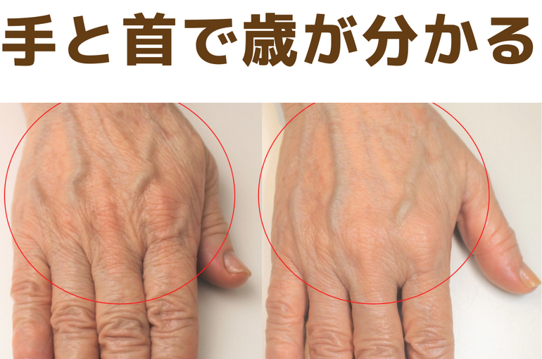 手の写真