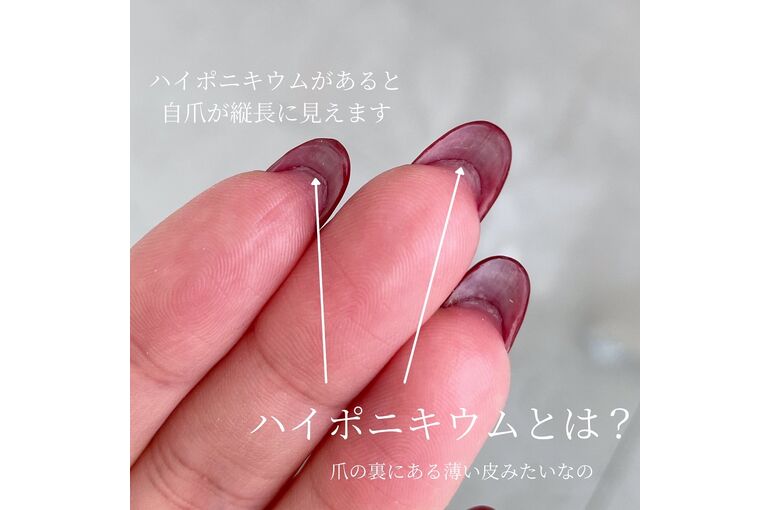 爪の裏の写真