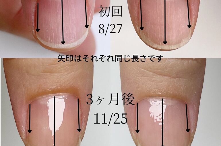 自爪育成写真