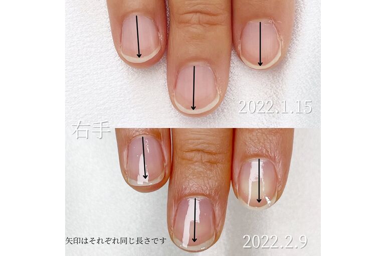 自爪育成写真