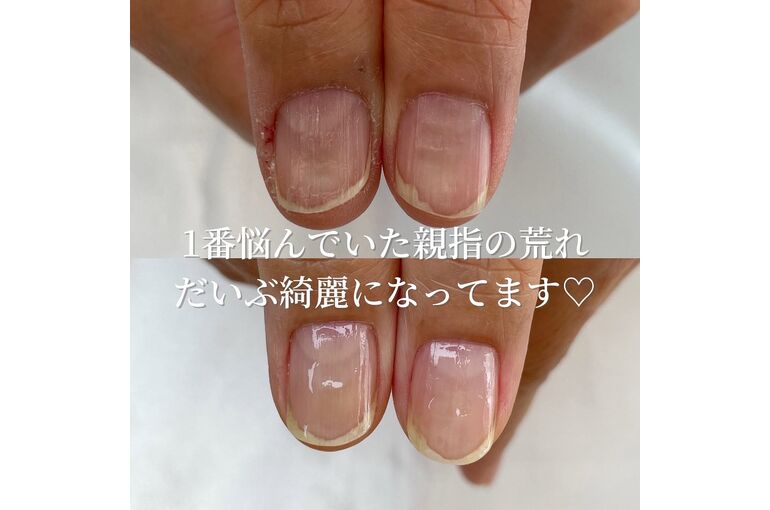 自爪育成写真