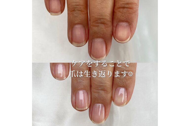 自爪育成写真