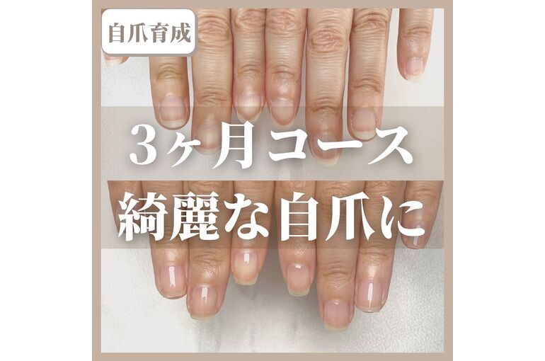 自爪育成写真
