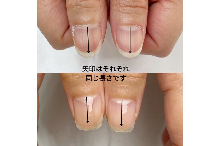 自爪育成写真