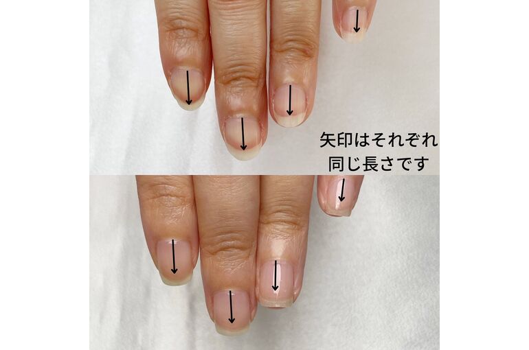 自爪育成写真