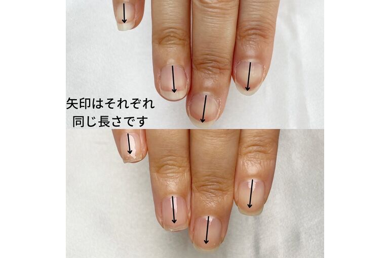 自爪育成写真