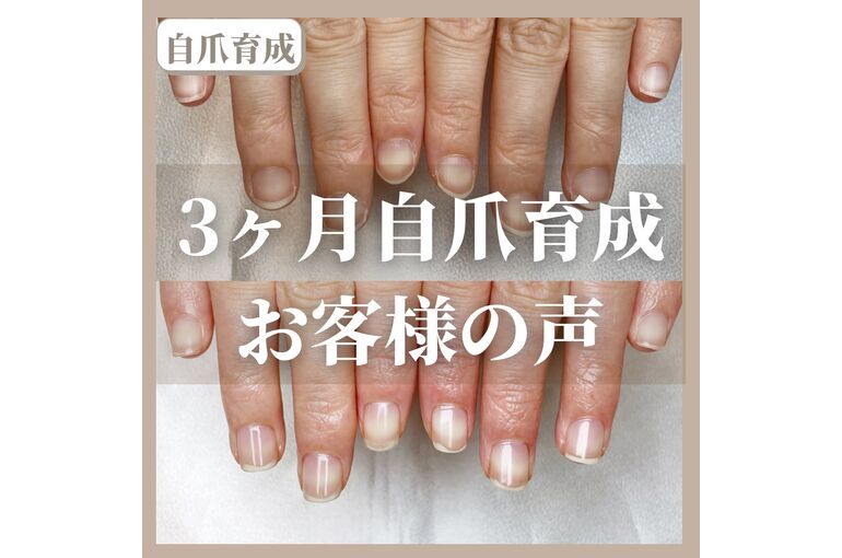 自爪育成写真