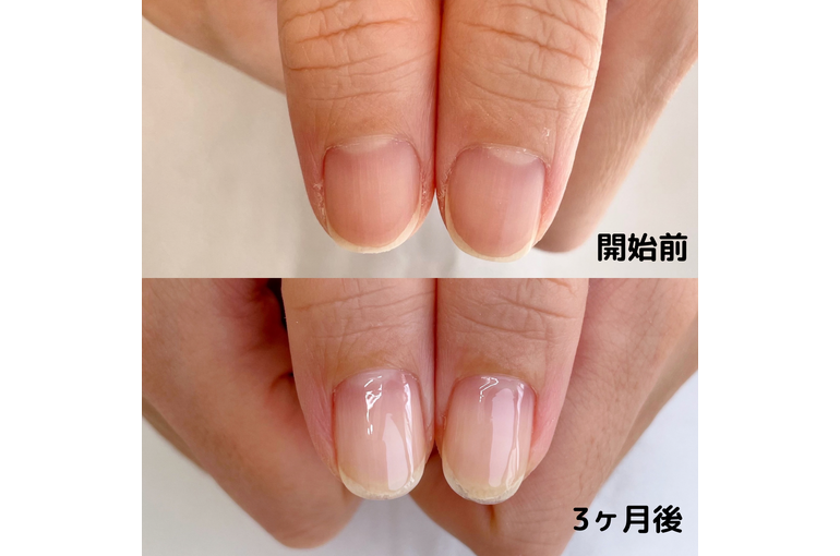 自爪育成写真