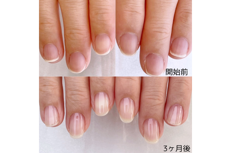 自爪育成写真