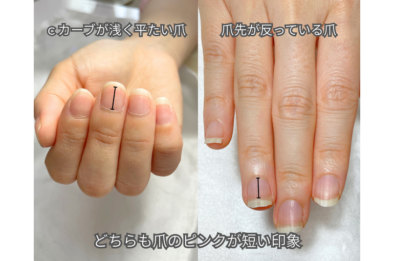 爪のピンクが短い