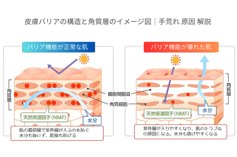 皮膚バリアの構造と角質層のイメージ図｜手荒れ 原因 解説
