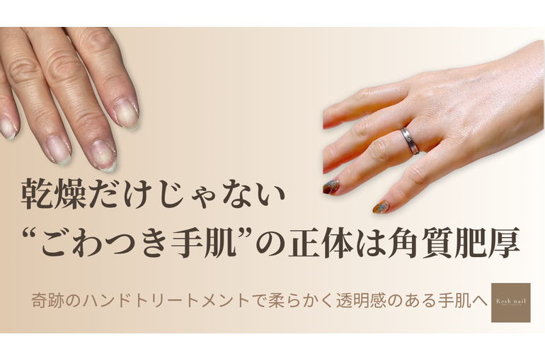 乾燥と角質肥厚でごわついた手のBeforeAfter｜ハンドケア 市川Resh nail