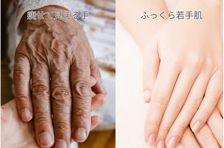 手の甲が痩せて見える手とふっくらした手の比較画像｜ボリュームロスのイメージ