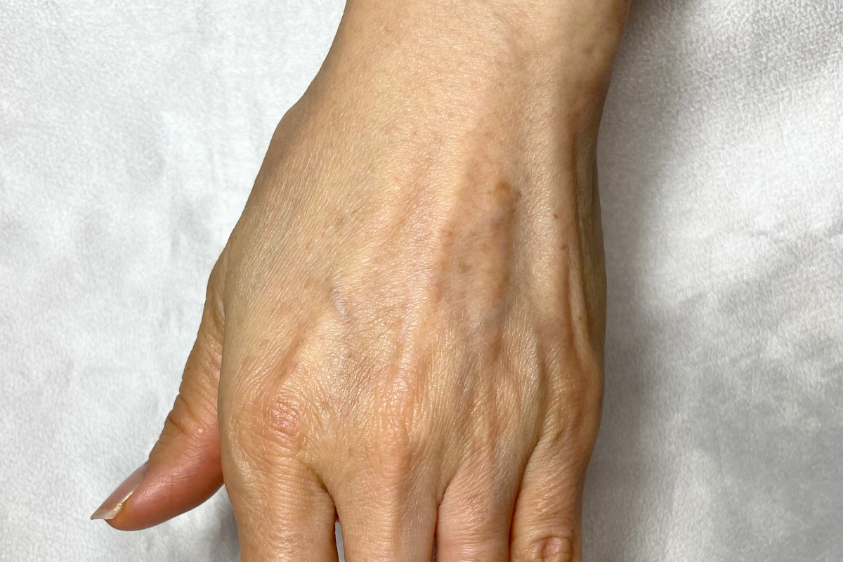手の甲に年齢によるシミが見られる手元の様子