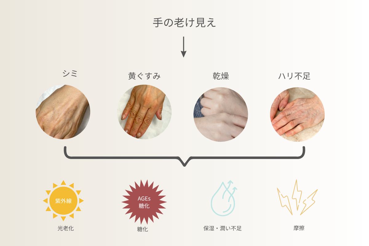 紫外線や糖化が手の老け見えにつながる仕組みをまとめた図解